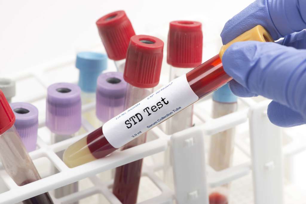std testing